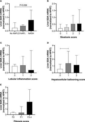 Ectodysplasin A Is Increased in Non-Alcoholic Fatty Liver Disease, But Is Not Associated With Type 2 Diabetes